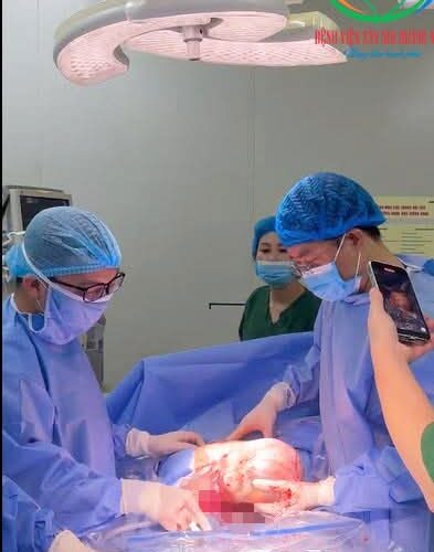 Bệnh viện Sản Nhi Quảng Ninh đón cặp song sinh hiếm gặp chào đời còn nguyên trong bọc ối